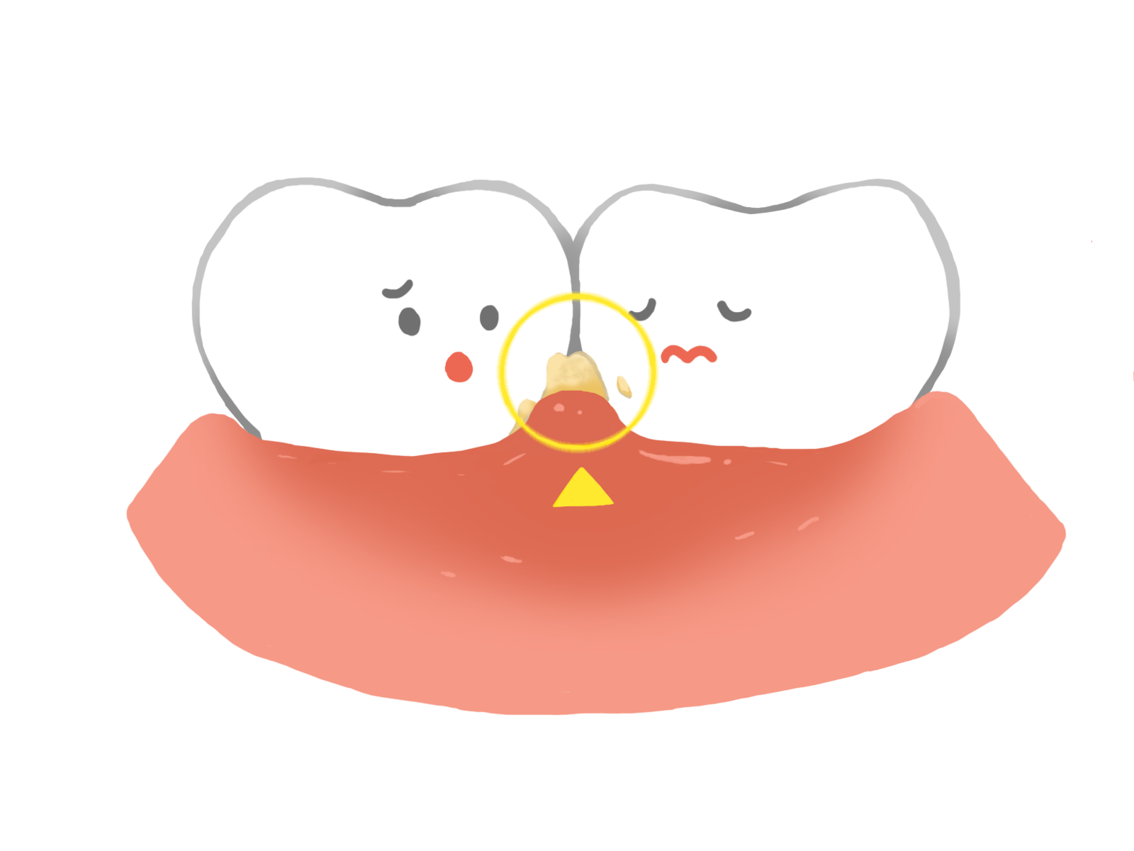 歯ぐきからのサイン、見逃していませんか？