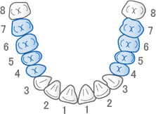 白い歯の治療が保険適用となる対象の歯